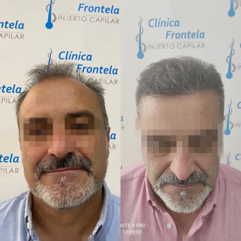 F52FDCAD-4BE3-444F-8FF0-0FD4436219D2-1024x1024-1-768x768-1.webp